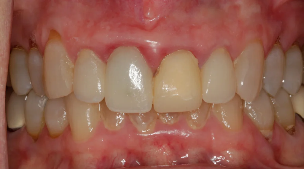 D'Amico Dental Care - top rated implant dentist - https://www.youtube.com/watch?v=k4crfuVf2to