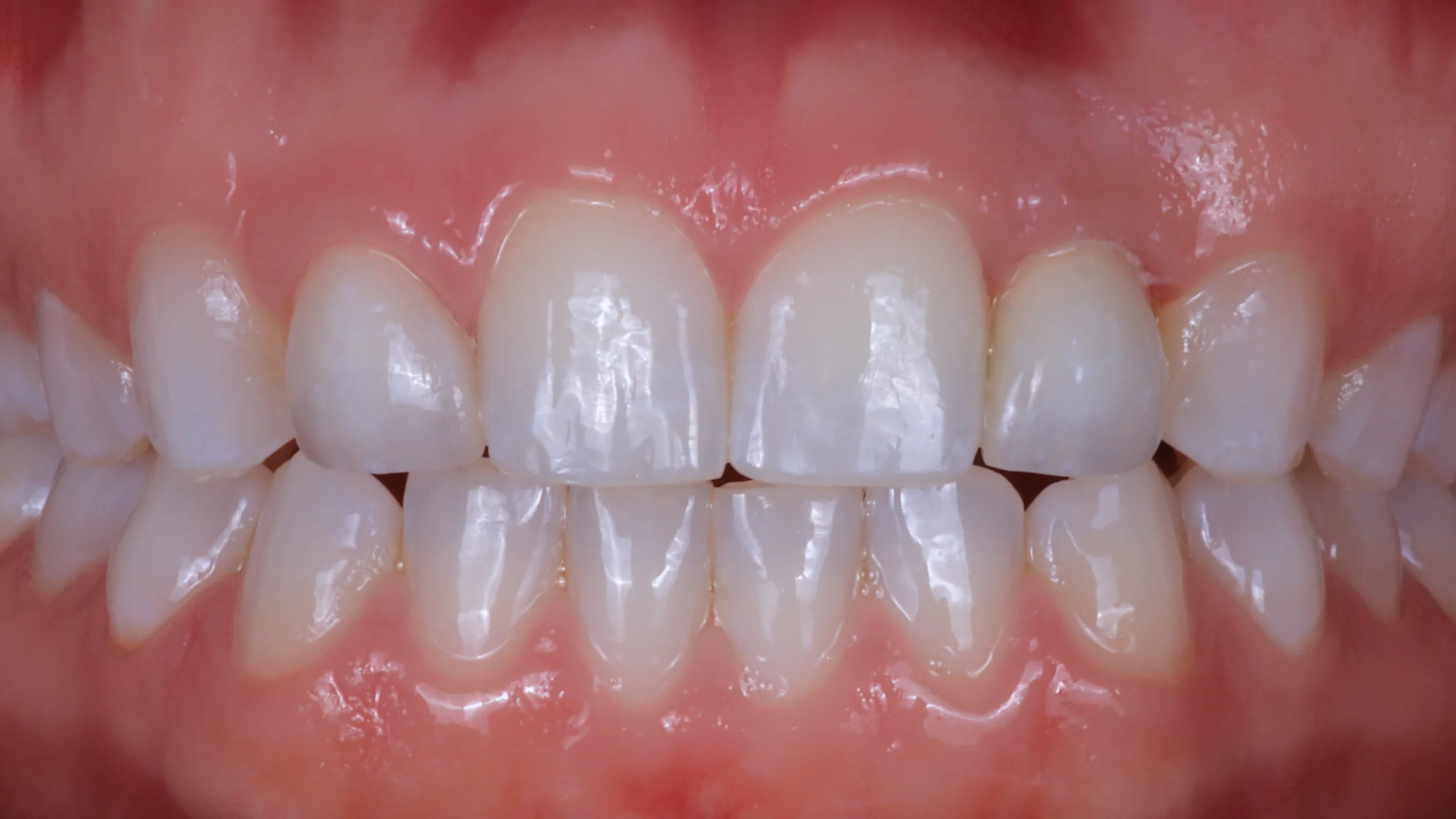 D'Amico Dental Care - top rated implant dentist - https://www.youtube.com/watch?v=k4crfuVf2to