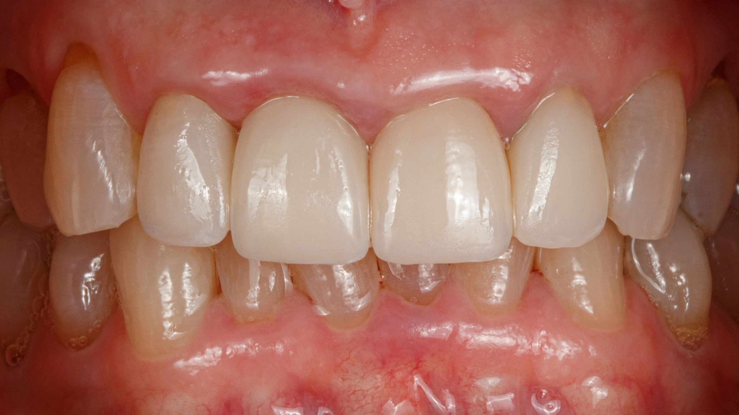 D'Amico Dental Care - top rated implant dentist - https://www.youtube.com/watch?v=k4crfuVf2to