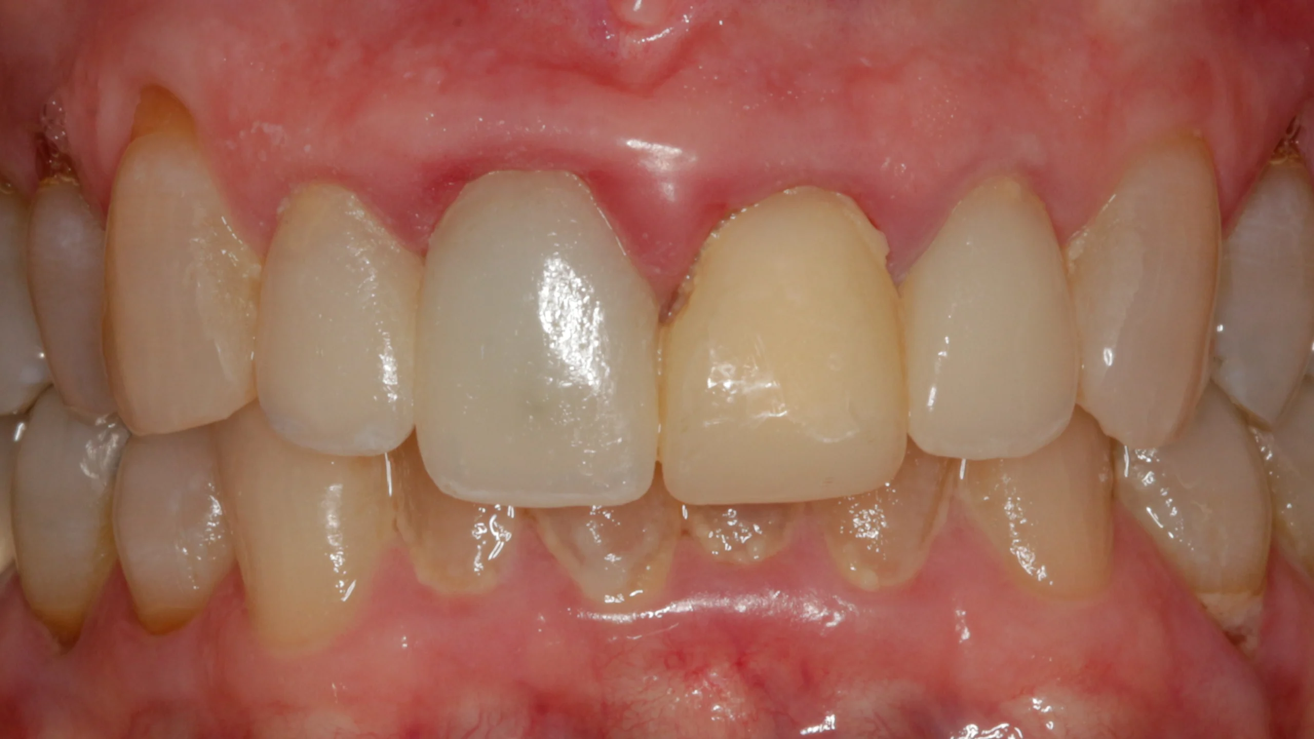 D'Amico Dental Care - top rated implant dentist - https://www.youtube.com/watch?v=k4crfuVf2to