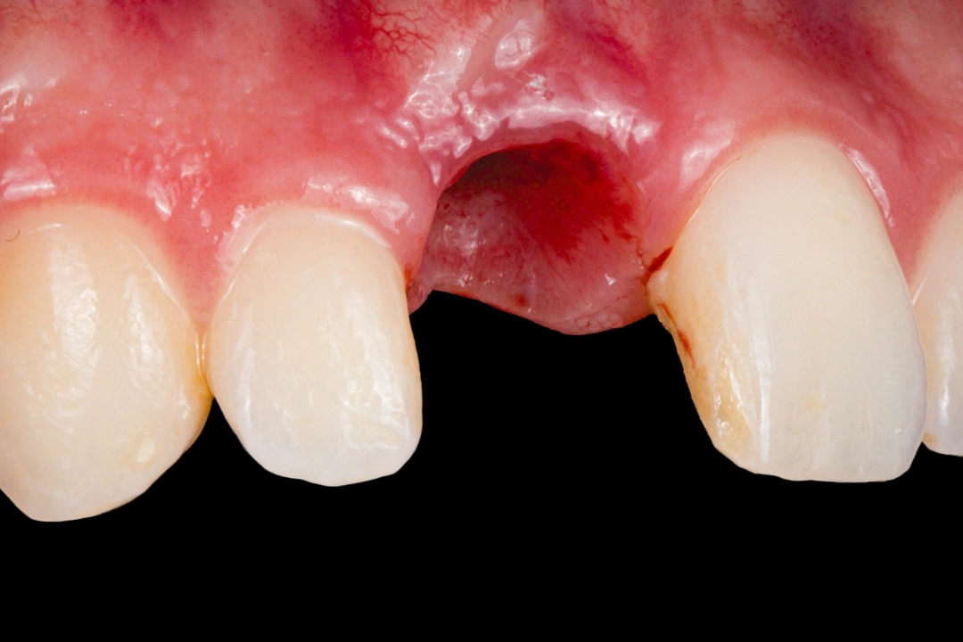 D'Amico Dental Care - top rated implant dentist - https://www.youtube.com/watch?v=k4crfuVf2to