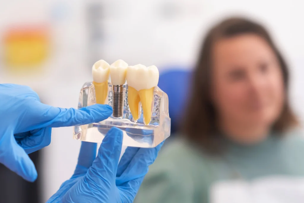 a Candidate for Dental Implants