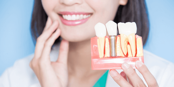 Dental implants aftercare