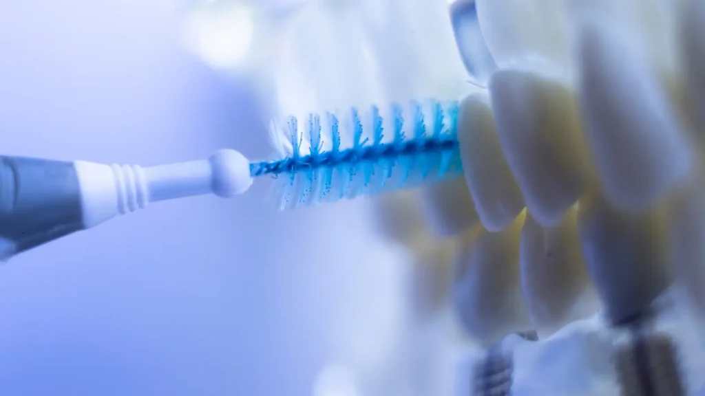 Role of Oral Hygiene in Implant Durability