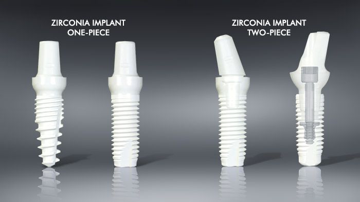 Zirconia Implants