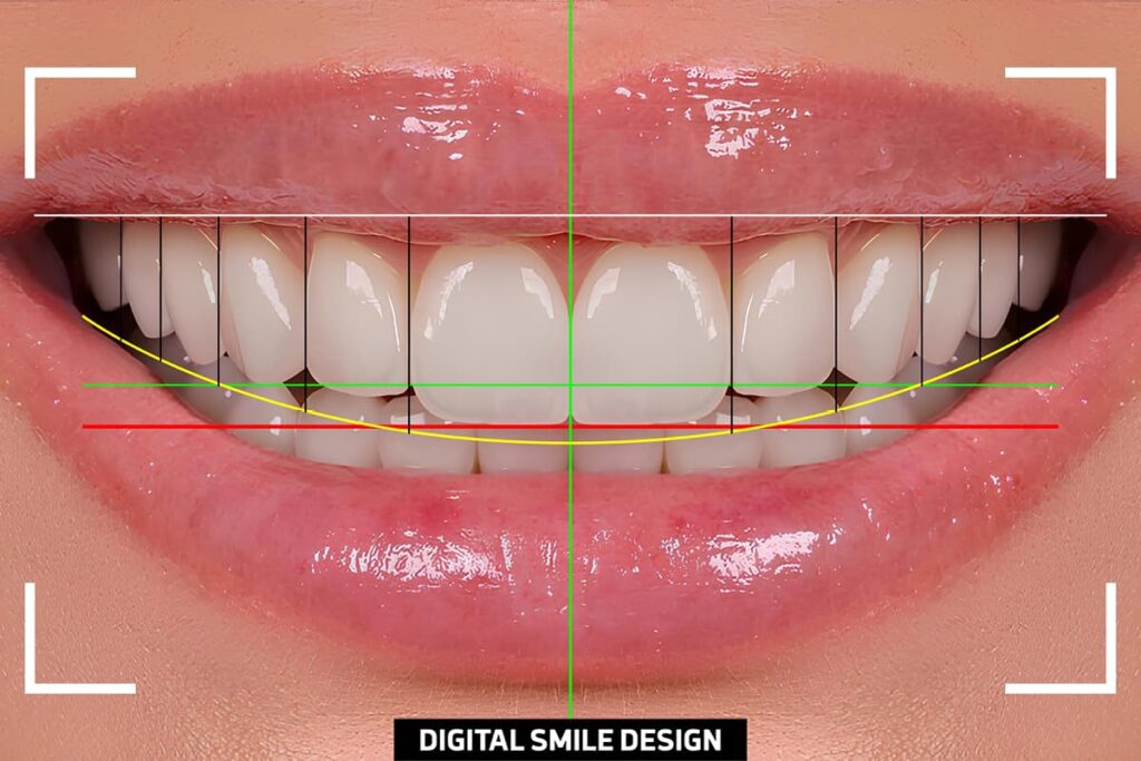 digital smile design advantages
