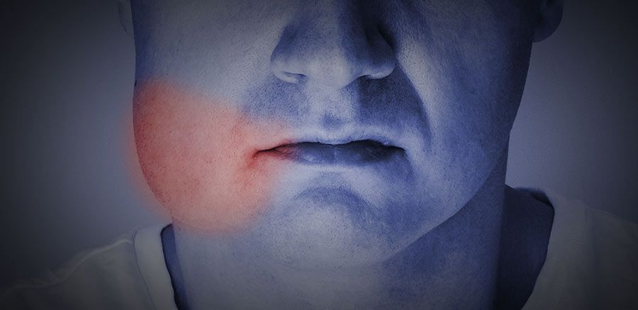 Abnormal Swelling After Implant Surgery