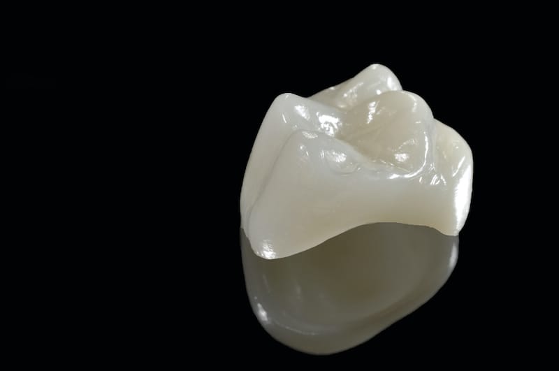 CEREC Crowns
