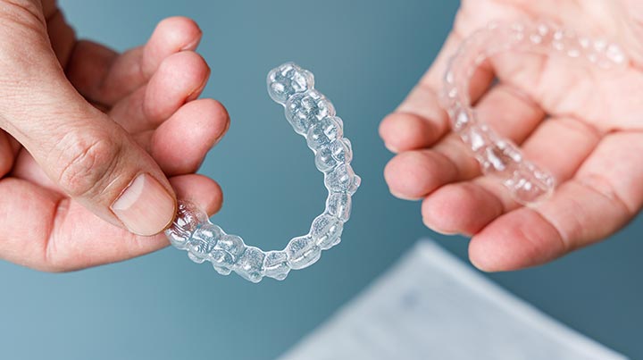  How Do SureSmile and Invisalign Work