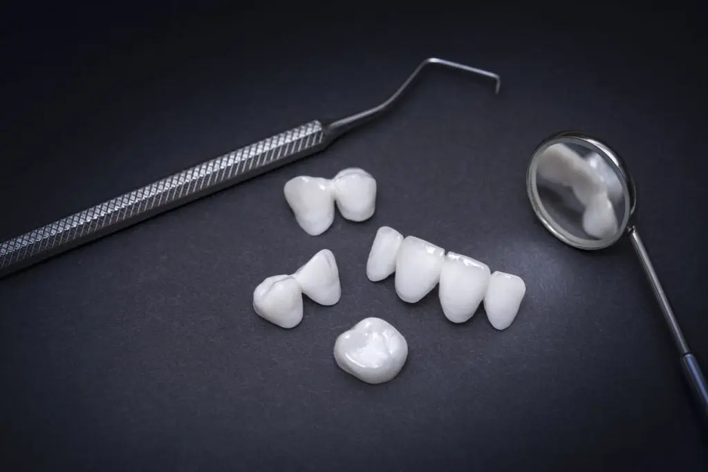 What Affects the Longevity of Veneers