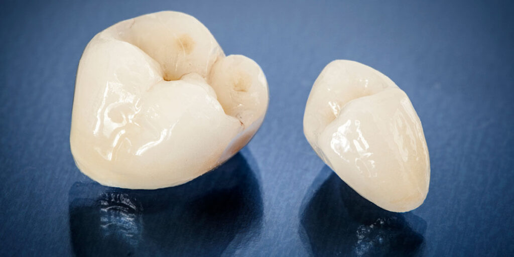 Uses for Porcelain Crowns