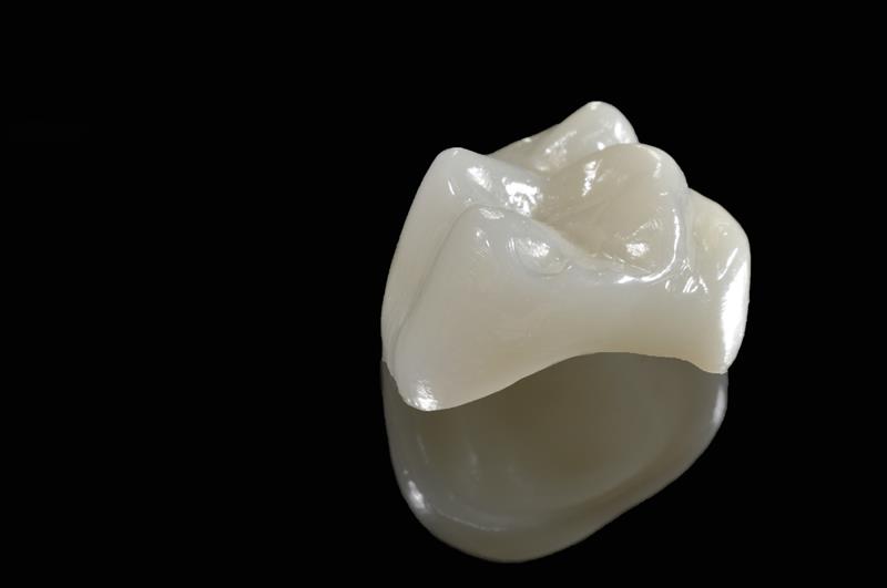 dental porcelain crowns