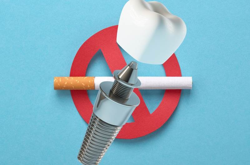smoking and dental implants