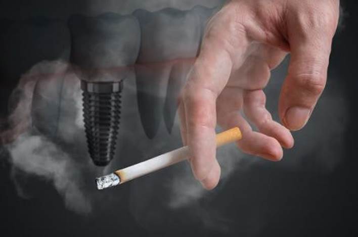The Effect of Smoking on Dental Implant Success Rates