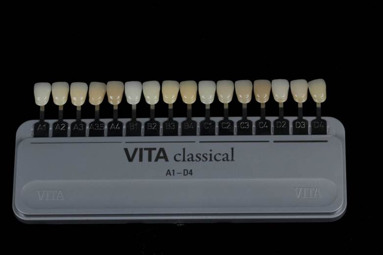 dental veneers shades in wayland