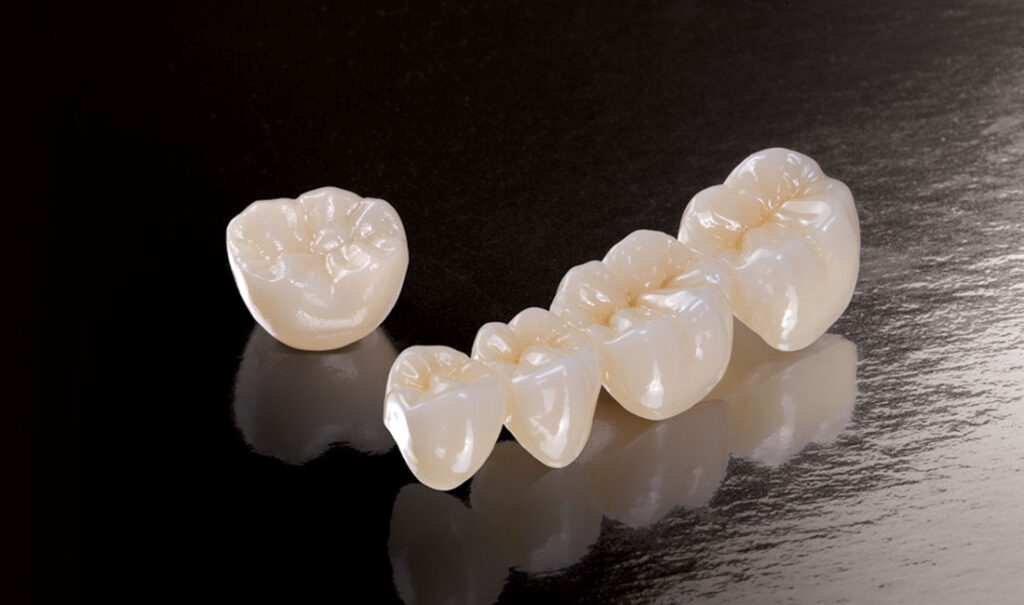 Ceramic Dental Crowns
