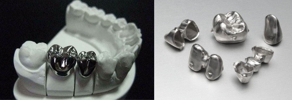 Metal Dental Crowns