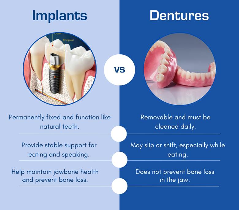 Pros and Cons of Dentures Compared to Dental Implants
