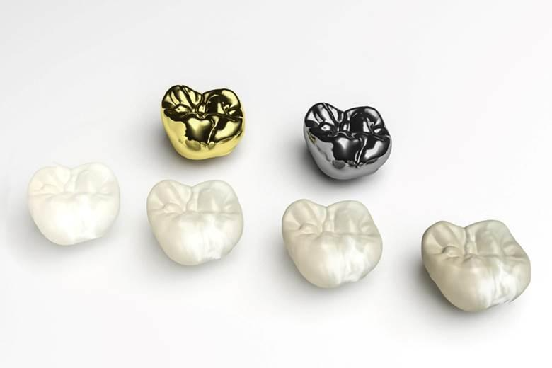 Bonding for Small Chips, Cracks & Minor Cosmetic Fixes