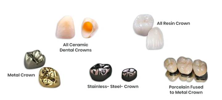 Common Materials of Dental Crown