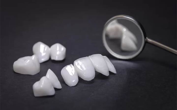 A set of porcelain veneers displayed on a dark surface