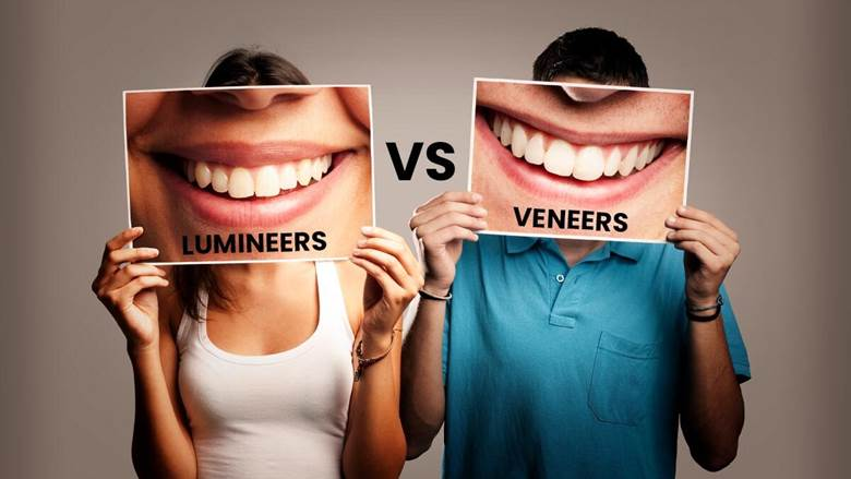 veneers vs lumineers