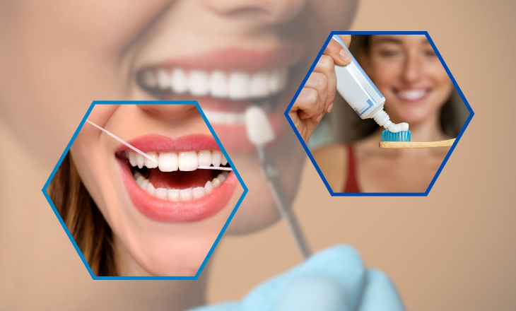 Caring for Veneers and Lumineers