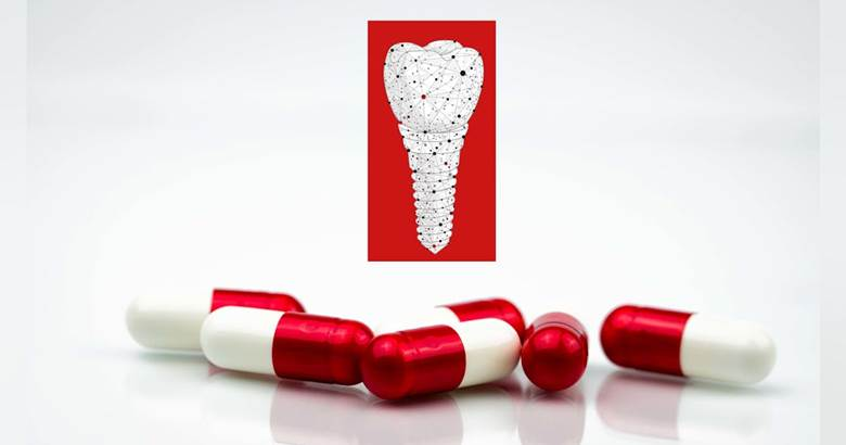 Role of Medications Such as Blood Thinners in dental implant process 