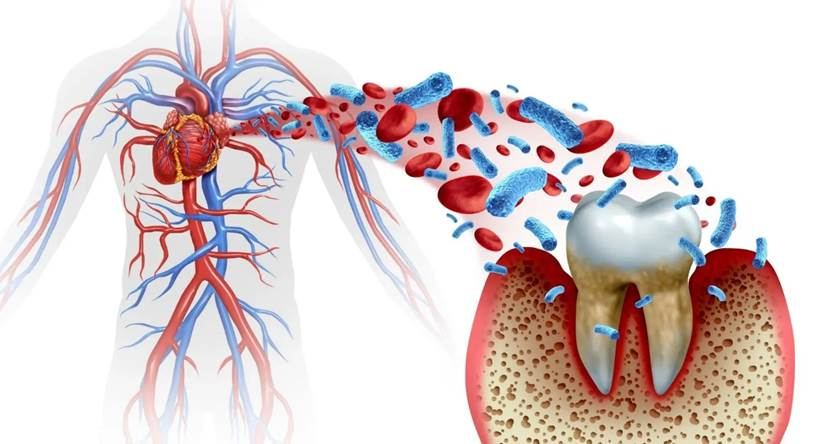 DAmico Dental Care - 7 Proven Ways to Ensure Safe Dental Implants for Heart Patients - Do you or a loved one have heart disease and are looking for a permanent solution to replace missing teeth? It's completely natural to be concerned about the safety of Dental implants for heart patients. However, with advancements in modern dentistry and close collaboration between your dentist and cardiologist, many heart patients can now safely benefit from this life-changing treatment.