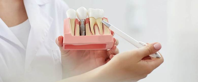 DAmico Dental Care - Best age to get dental implants: 6 Expert-Recommended Guidelines - Is your age right for dental implants? It's a common question for people across all age groups—from young adults to seniors. While age can influence the success of an implant, it isn't an absolute barrier. Key factors, such as complete jawbone development in younger patients, bone density in middle-aged patients, and overall health in seniors, are what your dentist will evaluate to guide the decision. This guide explores the best age to get dental implants for each stage of life, the factors affecting treatment success, and optimized strategies for achieving a natural, long-lasting result. With expert consultation and careful planning, people of any age can enjoy the benefits of dental implants.