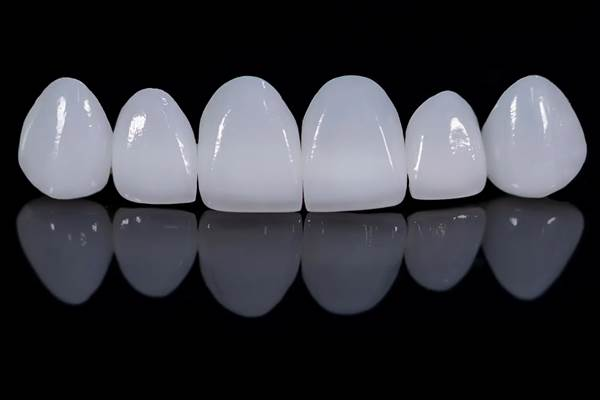 The Pros and Cons of Veneers for Crooked Teeth