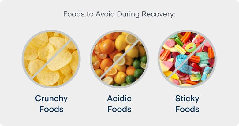 avoiding Sticky, Crunchy, and Acidic Foods after dental implant