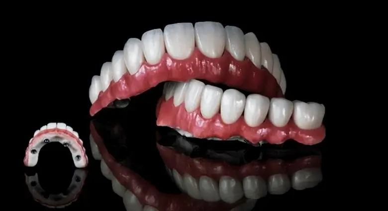 when need to bone graft in dental implants