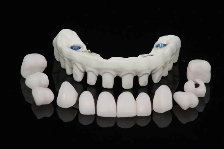 Procedure Day: Extractions, Placement, and Temporary Fixed Teeth