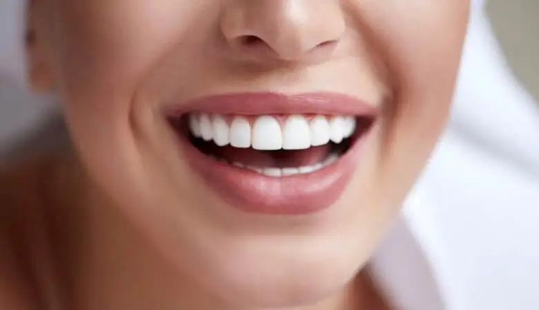 porcelain veneers & Esthetic Dentistry in damico dental care