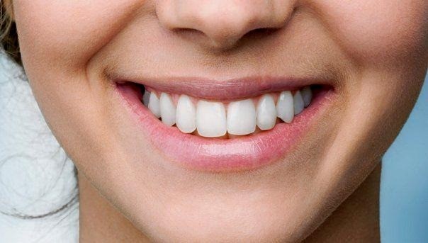 The Final Smile: Crafting Your Permanent Full Arch