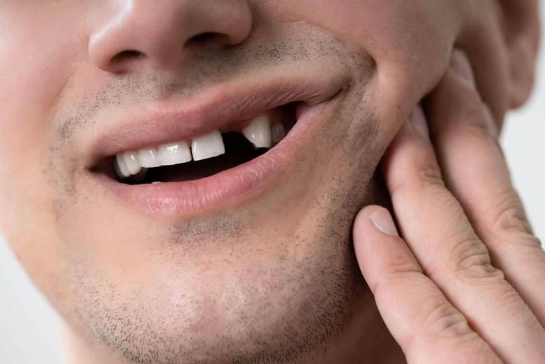 DAmico Dental Care - General Dentistry - In 2025, general dentistry in Watertown and Wayland offers advanced, comprehensive care—this guide covers the latest innovations, common services, and tips for choosing top dentists.