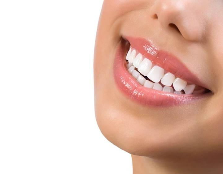 Digital Smile Design in Watertown