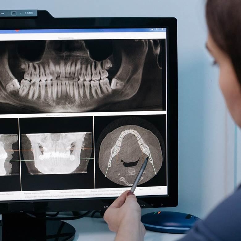 3D Imaging (CBCT) in Watertown & Wayland