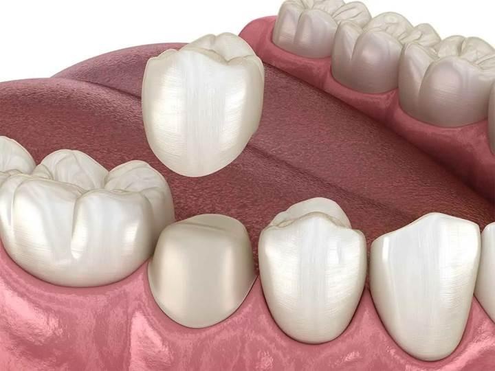 General Dentistry in Wayland