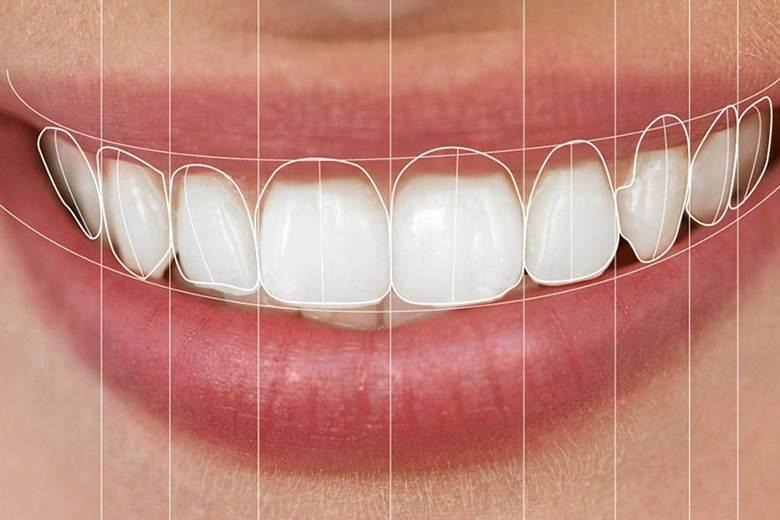 Digital Smile Design and Dental Veneer