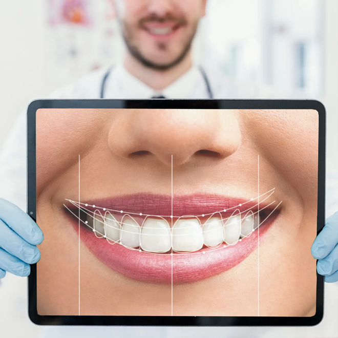 Digital Smile Design in Wayland