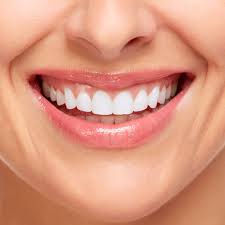 Esthetic Dentistry in watertown