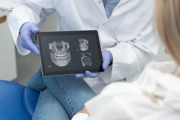 D'Amico Dental Care - How Cutting-Edge Digital Planning is Transforming Dental Implant Success in 2025: Precision, Safety, and Faster Recovery at D'Amico - Did you know that inadequate digital planning is one of the leading causes of dental implant failure? Today, with the advent of advanced digital technologies, this risk has been significantly reduced. At D'Amico Dental in Wayland and Watertown, we have transformed implant placement into a precise, predictable, and thoroughly calculated process. Using 3D implant planning, every step of the treatment is designed with micron-level accuracy to achieve the best possible outcome.