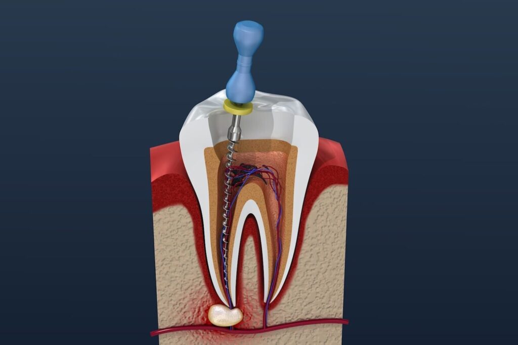 Why Does a Tooth “Die”?