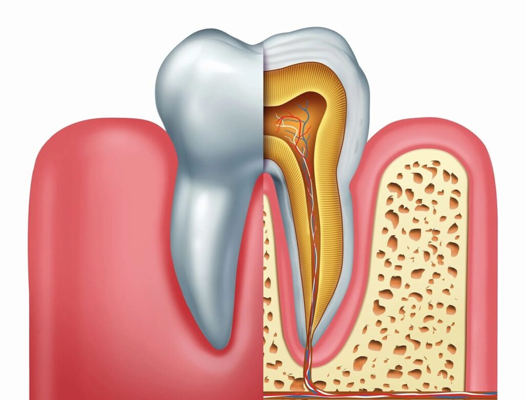 root treatment aftercare and cost in d'amico dental care in wayland & watertown