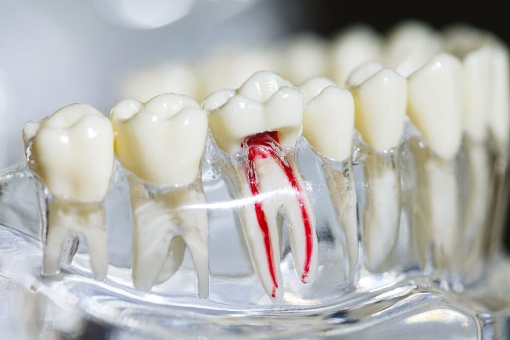 good candidate for root canal in Wayland & Watertown, MA