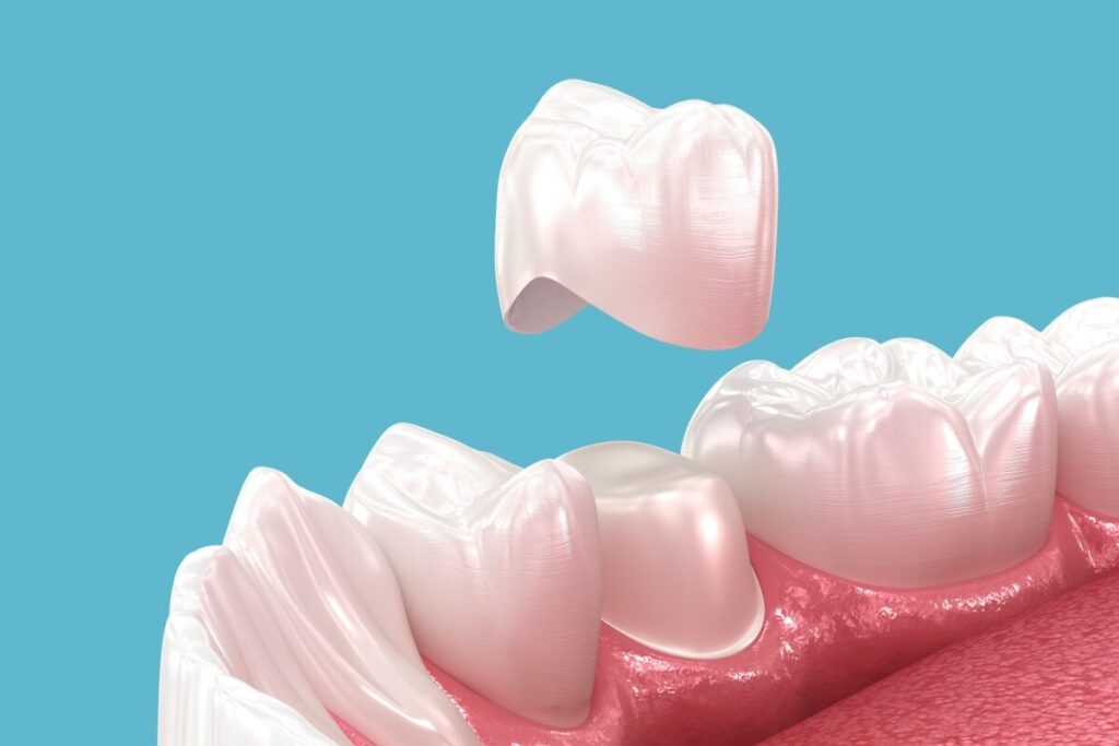 dental crown cost in watertown, ma