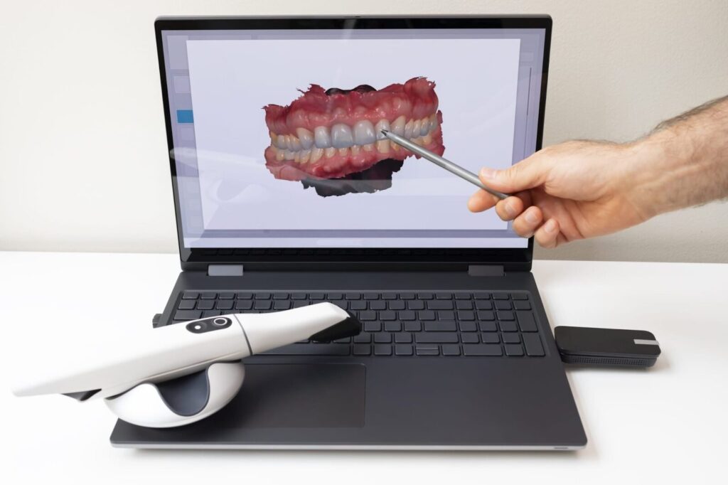 dental impressions in wayland