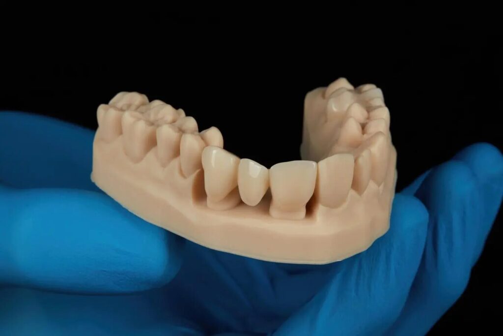 D'Amico Dental Care - 3D Printed Crowns Invisalign in Wayland & Watertown, MA: Faster, Easier, and More Accurate Than Ever Before 2025 - Stop wondering when your perfect smile arrives. Discover your exact Invisalign timeline, proven shortcuts to faster results, and why 12 months from now you could be smiling confidently—or still waiting.
